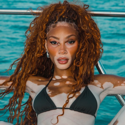 Winnie Harlow profile Photo