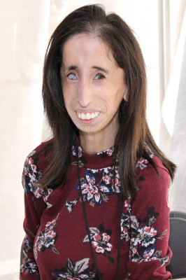 Lizzie Velásquez profile Photo